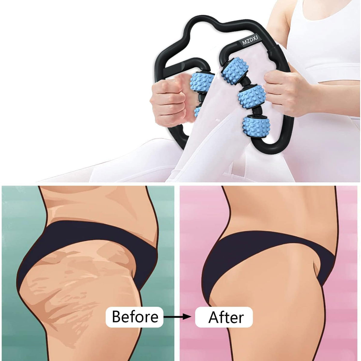 Cellulite Massage Tool Deep Fascia Massager & Dimpled Skin Remover for Legs - Anti-Cellulite Roller Tech with Lymphatic Drainage, Smooth Skin & Pain Relief for Thighs & Buttocks Sculpting