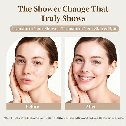 BRIGHT SHOWERS Filtered Shower Head, High Pressure Shower Filter for Hard Water to Remove Chlorine and Impurities, 8 Spray Modes Water Softener Showerhead for Hair and Skin Care, Chrome