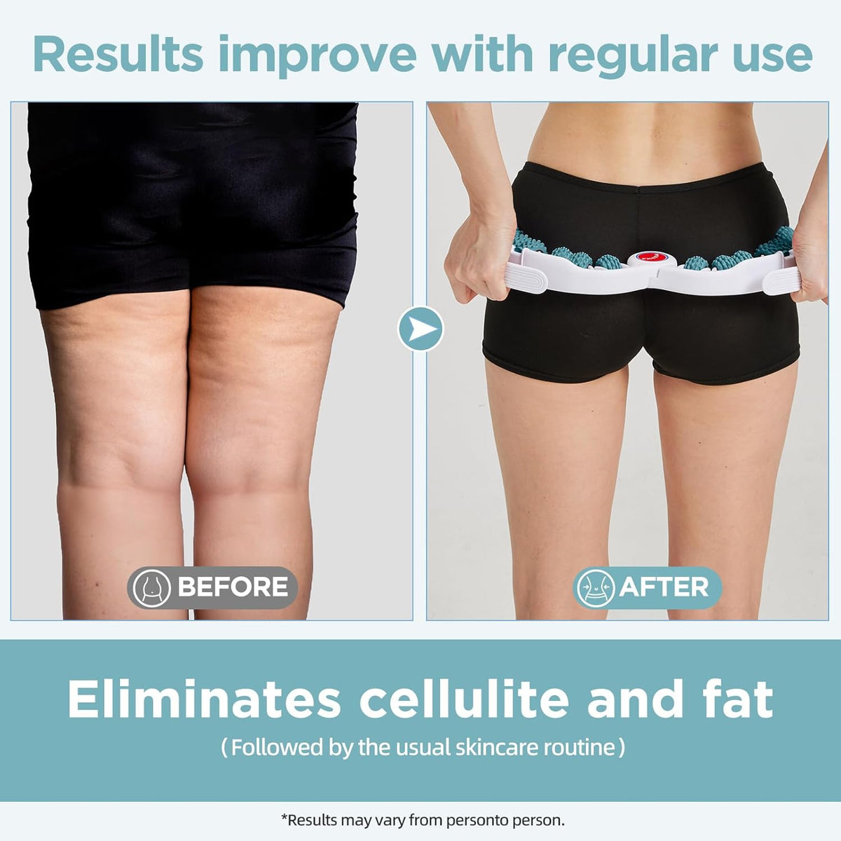 Cellulite Massage Tool Deep Fascia Massager & Dimpled Skin Remover for Legs - Anti-Cellulite Roller Tech with Lymphatic Drainage, Smooth Skin & Pain Relief for Thighs & Buttocks Sculpting