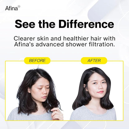 Afina Filtered Shower Head - Water Softener Showerhead with KDF-55 Filter for Hard Water - High Pressure Rain Fall Experience - Universal Fit - Matte Black